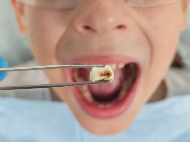 Best Urgent Care for Lost Fillings or Crowns in Innotion, VA
